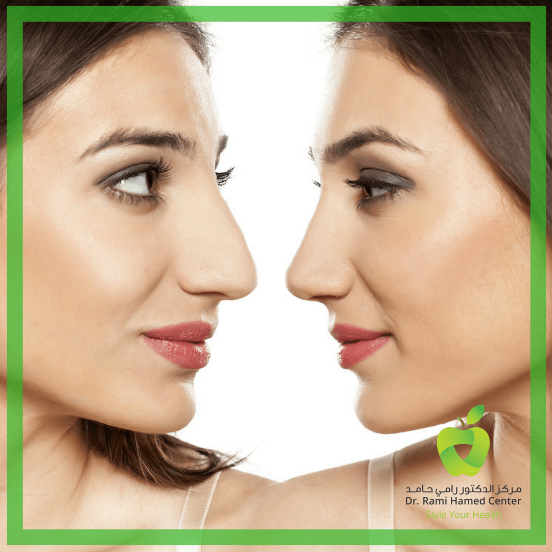 Nose Job Dubai Rhinoplasty